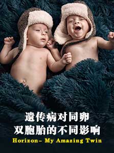 遗传病对同卵双胞胎的不同影响